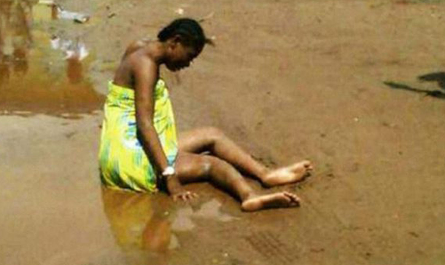 Elle sort d’un hôtel et se fait écraser la jambe par le véhicule de son copain